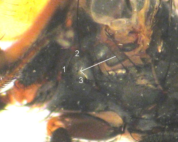 Sternopleural Bristles