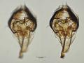 Click to view scaptomyza_pallida_epandrium_t1.jpg