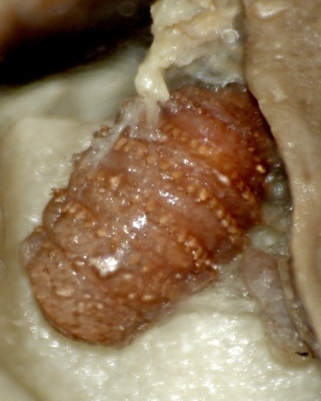 gasterophilus_intestinalis_larva.jpg